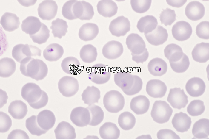 Plasmodium falciparum x640 - gryphea.org